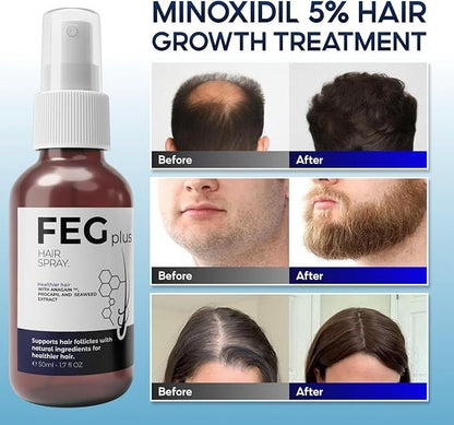 Hair Growth Spray PLUS - Barakaq